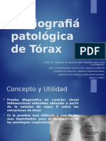 Neumologia - Radiografiá Patológica de Tórax