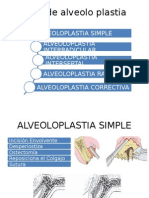 Tipos de Alveolo Plastia