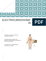 Electro CardiografíA