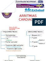 Arritmias cardiacas: tipos, causas y tratamientos