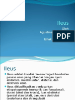 Ileus