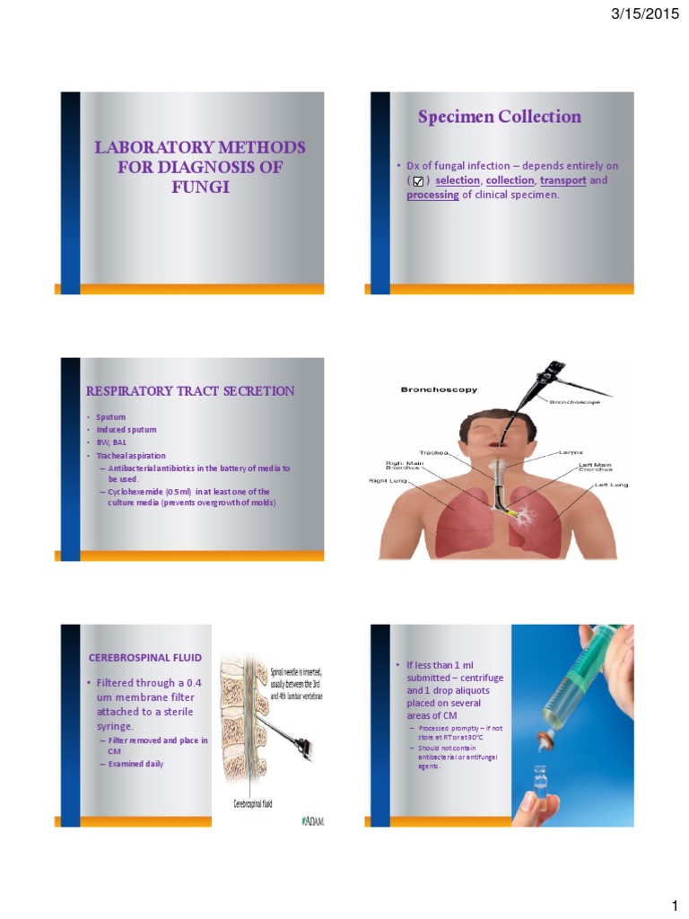 Laboratory Methods of Diagnosis of Fungal infections Staining
