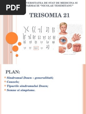 Trisomia 21