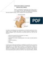 Artrosis Cadera: Causas, Síntomas y Tratamiento