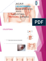 Colostomia