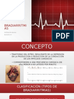 Bradiarritmias y bloqueos auriculoventriculares