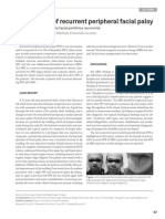 A Rare Cause of Recurrent Peripheral Facial Palsy PDF