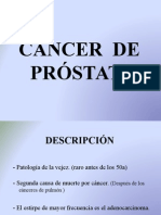 Cancer de Prostata