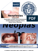 Neoplasias