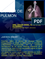 Cancer de Pulmon Angel