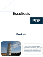 Escoliosis