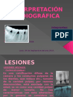 Interpretación Radiográfica