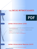 Técnicas Intraoculares