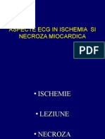 Aspecte ECG in Ischemia Si Necroza Miocardica
