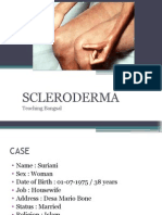 Scleroderma