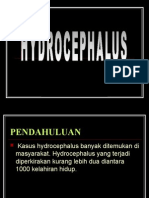 HIDROCEPHALUS