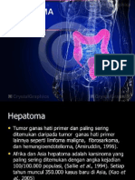 hepatoma slide.pptx