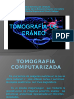 diapositivasdetomografiadecraneo-131117112629-phpapp02.pptx