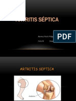 Artritis séptica: causas, síntomas y tratamiento