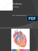 Cardiac Arrhythmias: Abnormal of Cardiac Rhythm