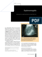 Evaluacion de Esplenomegalia PDF