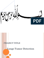Lung Tumor Detection
