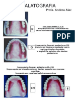 palatografia.ppt