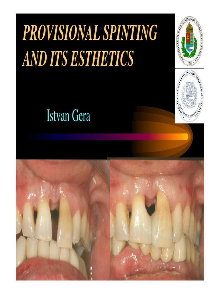 9. Provisional Splinting 2013 Human Tooth Oral Hygiene
