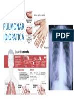 FIPBROSIS PULMONAR IDIOPATICA