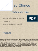 Caso Clínico Fractura Tibia