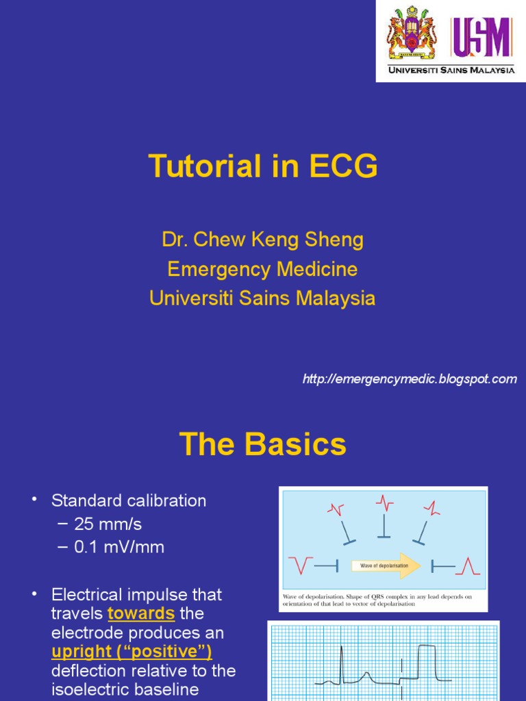 Image Result For Electrocardiogram Ecg Singhealth
