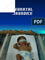 Neonatal Jaundice