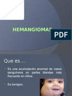 Hemangiomas