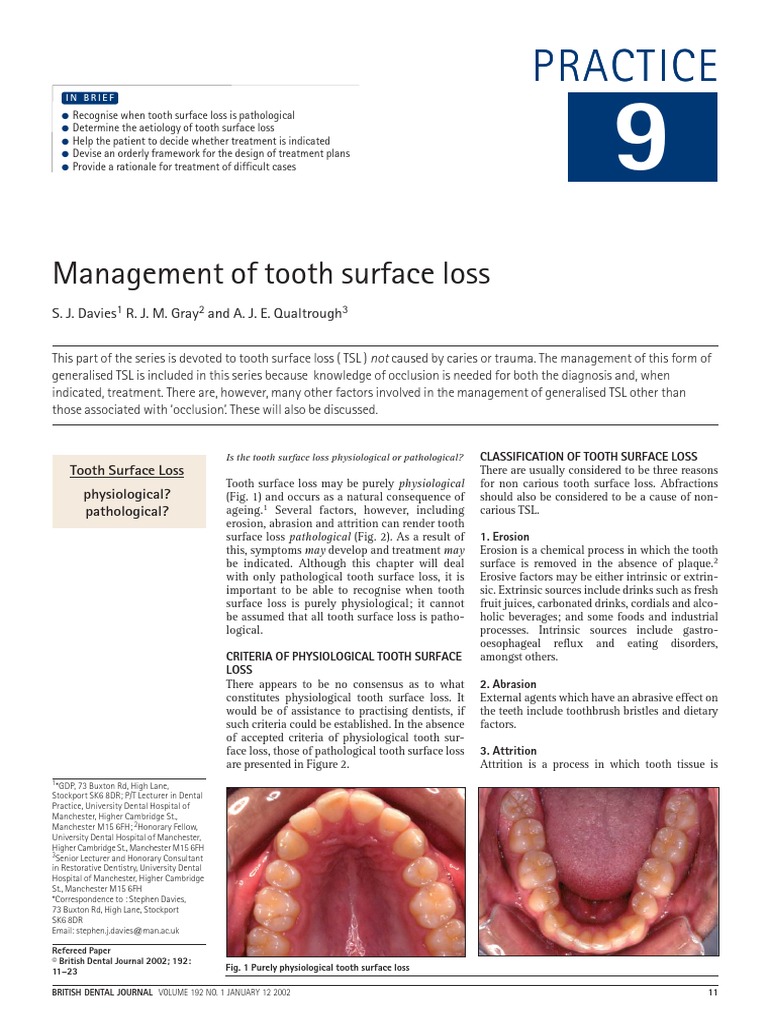 Management of Tooth Surface Loss (by Bruxism) Mouth Medicine