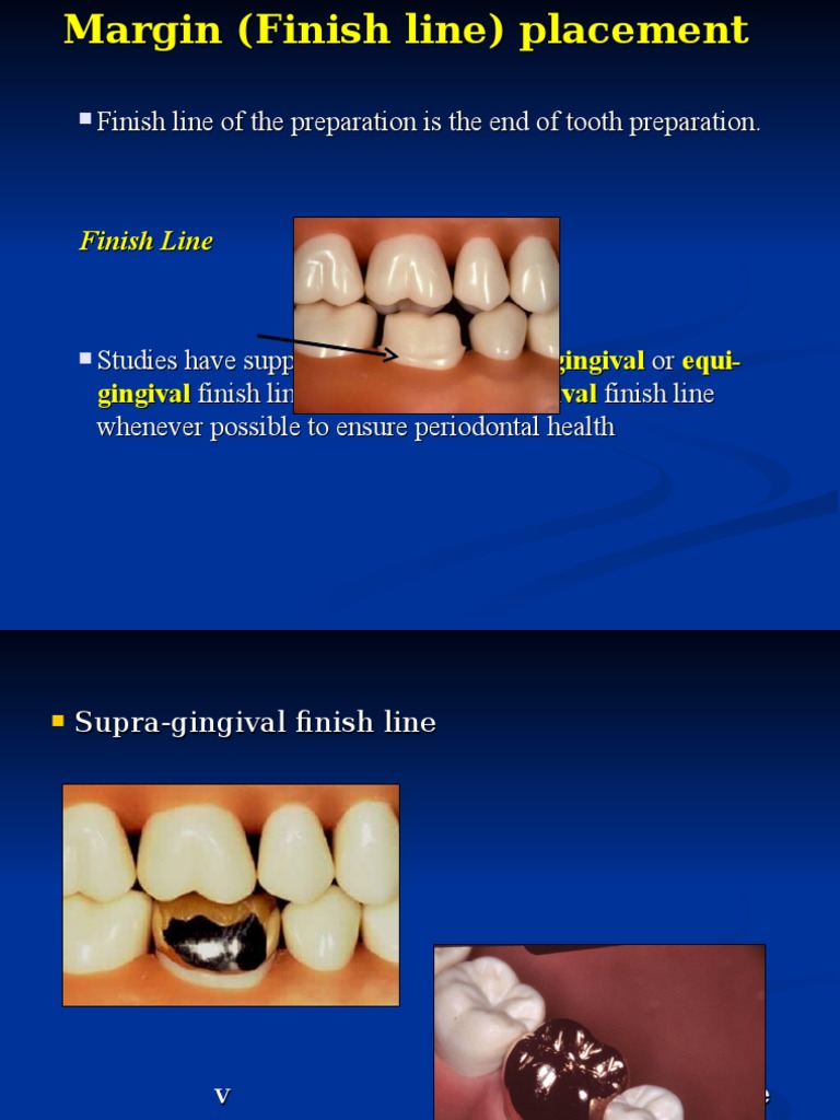 Finish Lines Mouth Dentistry