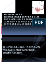 Electrocardiograma