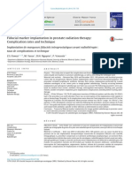 Fiducial Marker Implantation in Prostate Radiation Therapy - Complication Rates and Technique