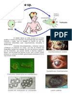 Acanthamoeba SP