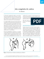 Actualidades en Luxacion de Cadera