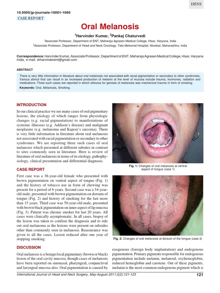 Smoker's Melanosis in Oral Cavity | PDF | Melanoma