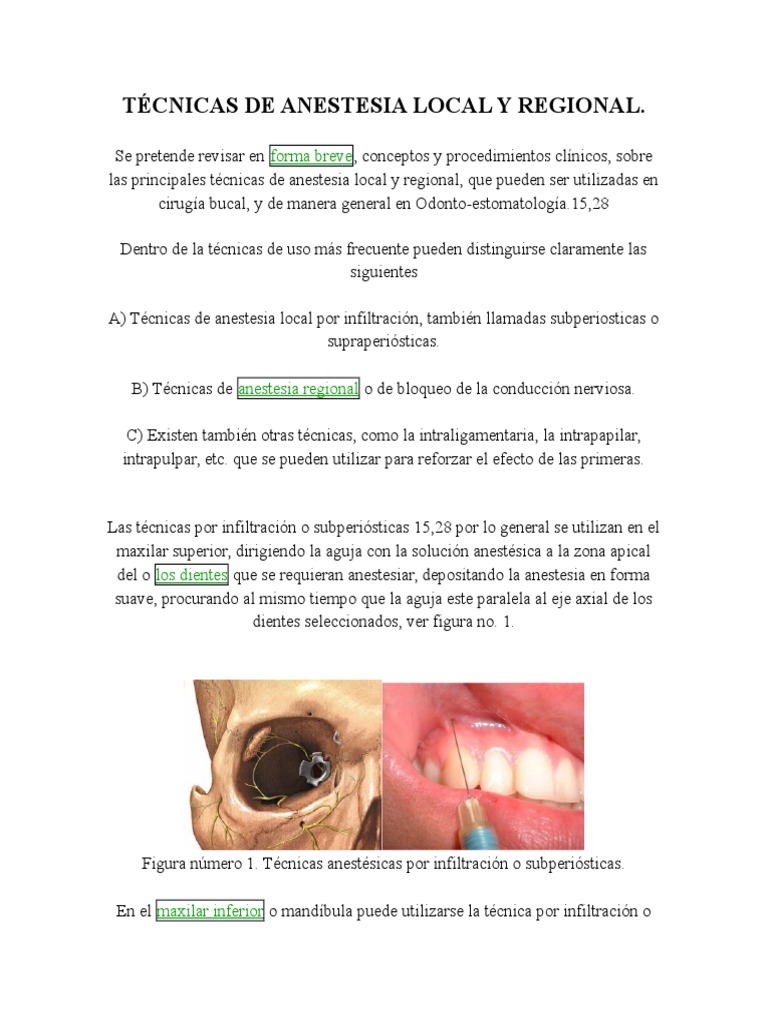 Técnicas De Anestesia Local Y Regional 1 - 