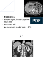 Simple renal cyst: low risk characteristics