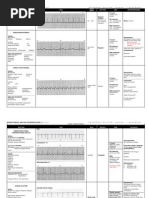 Dysrhythmias Chart