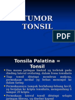 Tumor Tonsil 