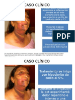 CaCaso Clinico Enfisema