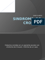 Sindrome de Crouzon