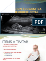 Evaluación ecográfica del neuroeje fetal en
