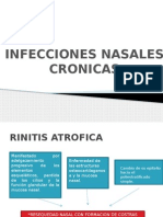 Procesos Infecciosos Cronica de La Nariz