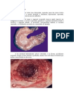 Doença de Crohn: características macro e microscópicas