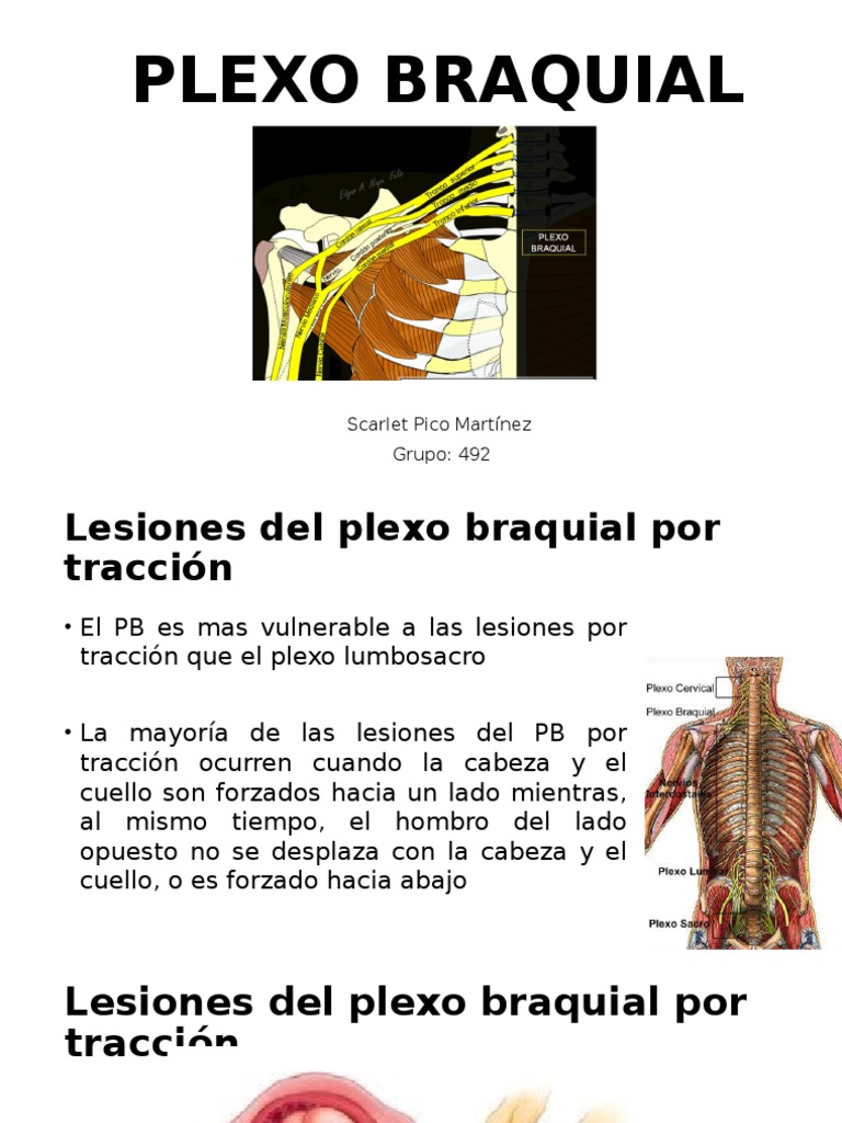 Plexo Braquial Pdf Codo Parto